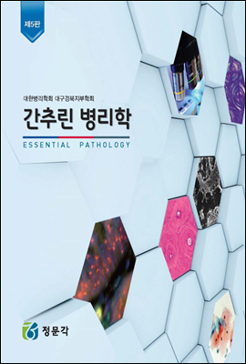 ���߸� ������